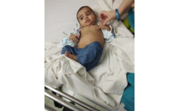 Chloecord cyst in children